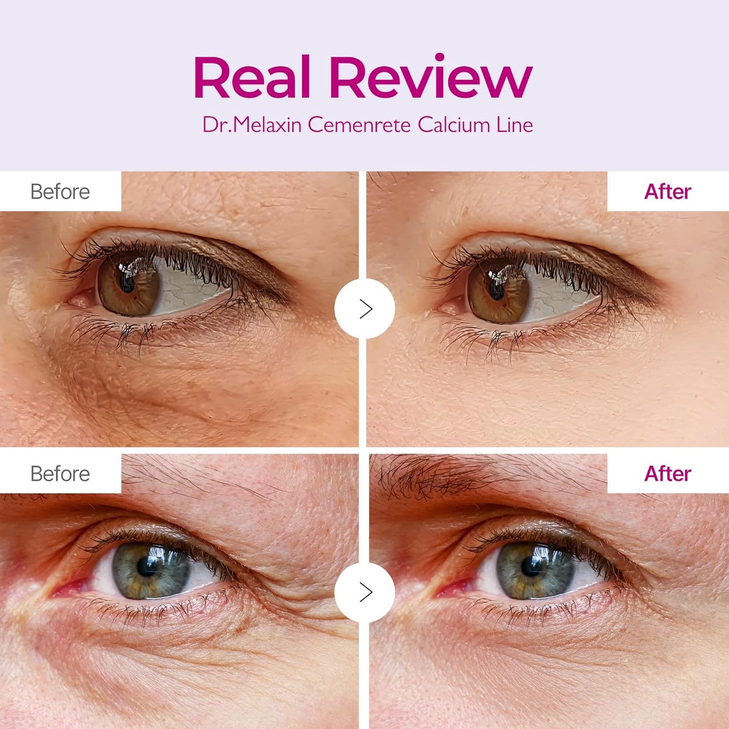 Dr. Melaxin Calcium Volume Eye Patch — Smooth, Bright & Lift Tired Eyes Fast