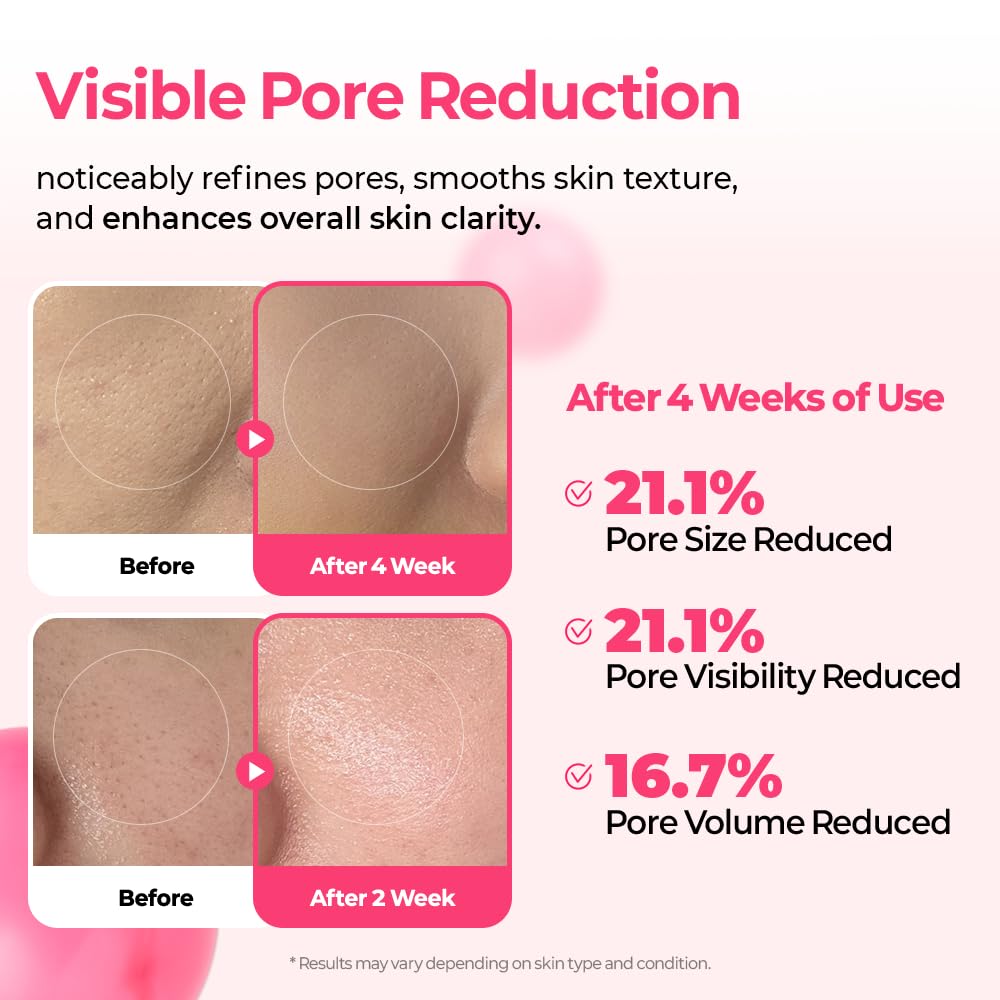 Dr. Melaxin Cyano Pink Spicule Niacinamide Serum — Shrink Pores & Smooth Texture Fast