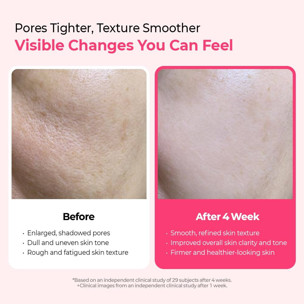 Dr. Melaxin Cyano Pink Spicule Niacinamide Serum — Shrink Pores & Smooth Texture Fast
