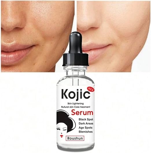 Kojic Acid Brightening Serum - 30ml