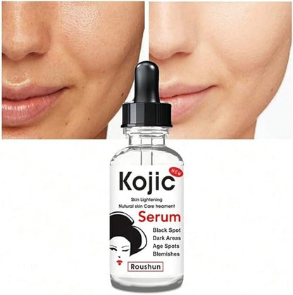 Kojic Acid Brightening Serum - 30ml