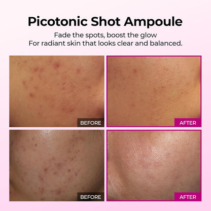 Dr. Melaxin Picotonic Shot Calcium Serum — Fade Dark Spots & Firm Skin Fast