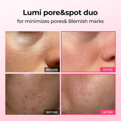 Dr. Melaxin Cyano Pink Spicule + Picotonic Shot — Shrink Pores & Fade Dark Spots