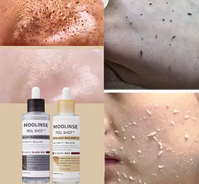 Korean White & Black Rice Exfoliating Serum — Smooth Texture, Clear Pores & Hydrate Skin