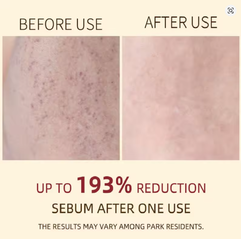 Korean White & Black Rice Exfoliating Serum — Smooth Texture, Clear Pores & Hydrate Skin