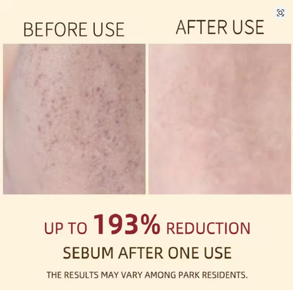 Korean White & Black Rice Exfoliating Serum — Smooth Texture, Clear Pores & Hydrate Skin