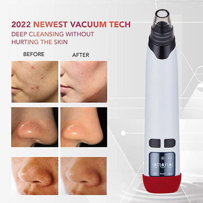 Electronic Facial Pore Cleaner and Blackhead Remover